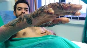 recreating human skin recreating human skin