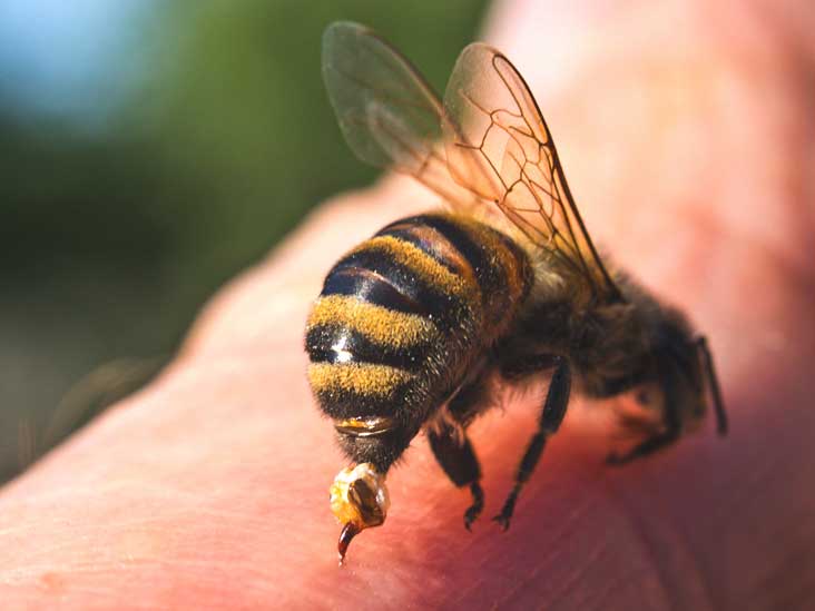 bee sting bee sting