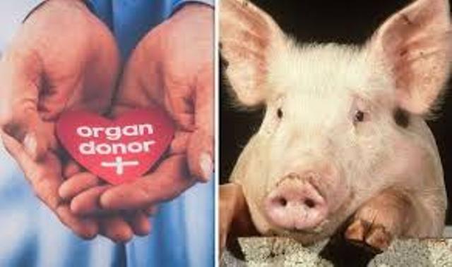 pig organ transplant pig organ transplant