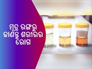 ମୂତ୍ର ରଙ୍ଗରୁ ଜାଣନ୍ତୁ ଶରୀରର ରୋଗ; ଏପରି ହିଁ ଜାଣିପାରେ ଆପଣ ସୁସ୍ଥ କି ଅସୁସ୍ଥ!