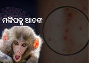 କାୟା ବଢାଉଛି ମଙ୍କିପକ୍ସ, ସତର୍କ କରାଇଲା କେନ୍ଦ୍ର