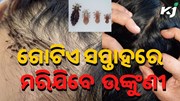 ମୁଣ୍ଡରେ ଉଙ୍କୁଣିକୁ ନେଇ ଚିନ୍ତିତ କି ? ସମୂଳେ ନାଶ କରିଦେବ ଏହି ପତ୍ର....