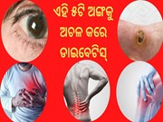 ଏହି ୫ଟି ଅଙ୍ଗକୁ ପୁରା ଅଚଳ କରିଦିଏ ଡାଇବେଟିସ୍‌, ଜାଣନ୍ତୁ...