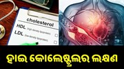 ହାଇକୋଲେଷ୍ଟ୍ରଲ ରୋଗ ପୂର୍ବରୁ ଦେଖା ଦେଇଥାଏ ଏହି ସବୁ ଲକ୍ଷଣ.... ହାଇକୋଲେଷ୍ଟ୍ରଲ ରୋଗ ପୂର୍ବରୁ ଦେଖା ଦେଇଥାଏ ଏହି ସବୁ ଲକ୍ଷଣ....