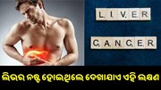 ଶରୀରରେ ଦେଖାଯାଉଛି କି ଏହି ୩ଟି ଲକ୍ଷଣ ? ତାହେଲେ ନଷ୍ଟ ହୋଇଯାଇଛି ଆପଣଙ୍କ ଲିଭର... ଶରୀରରେ ଦେଖାଯାଉଛି କି ଏହି ୩ଟି ଲକ୍ଷଣ ? ତାହେଲେ ନଷ୍ଟ ହୋଇଯାଇଛି ଆପଣଙ୍କ ଲିଭର...