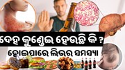 ଚର୍ମରେ ଦେଖାଯାଉଛି କି ଏହି ସବୁ ଲକ୍ଷଣ, ହୋଇପାରେ ଲିଭର ସମସ୍ୟା 