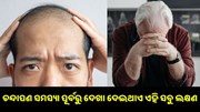 ଚନ୍ଦାପଣ ସମସ୍ୟା ପୂର୍ବରୁ ଦେଖା ଦେଇଥାଏ ଏହି ସବୁ ଲକ୍ଷଣ.. ଚନ୍ଦାପଣ ସମସ୍ୟା ପୂର୍ବରୁ ଦେଖା ଦେଇଥାଏ ଏହି ସବୁ ଲକ୍ଷଣ..