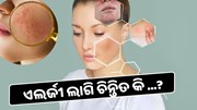 ଏଲର୍ଜୀ ଲାଗି ଆପଣ ଚିନ୍ତିତ କି ...? 