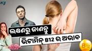 ଏହି ଲକ୍ଷଣରୁ ଜାଣନ୍ତୁ ହେଉଛି କି ଭିଟାମିନ୍ B12 ଅଭାବ ? କରନ୍ତୁ ଏହି କାମ 