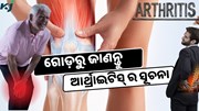 ଗୋଡ଼ର ଏହି ଲକ୍ଷଣରୁ ଜାଣନ୍ତୁ ଆର୍ଥ୍ରାଇଟିସ୍(Arthritis)ର ସୂଚନା, ଶୀଘ୍ର କରନ୍ତୁ ଚିକିତ୍ସା 